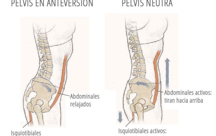 Pilates como tratamiento de la incontinencia urinaria de esfuerzo (I.U.E). Parte III