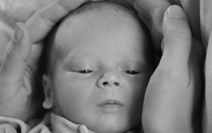 La plagiocefalia y la fisioterapia pediátrica