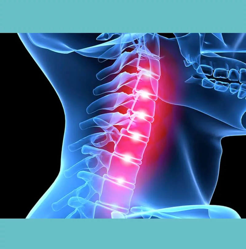 Cervicalgia