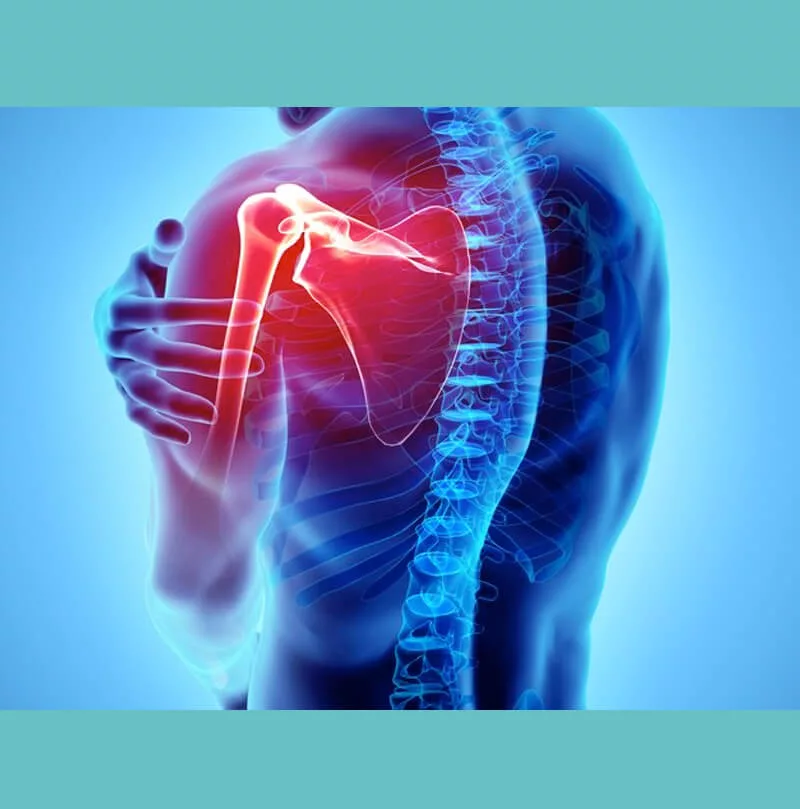 Tendinitis de supraespinoso
